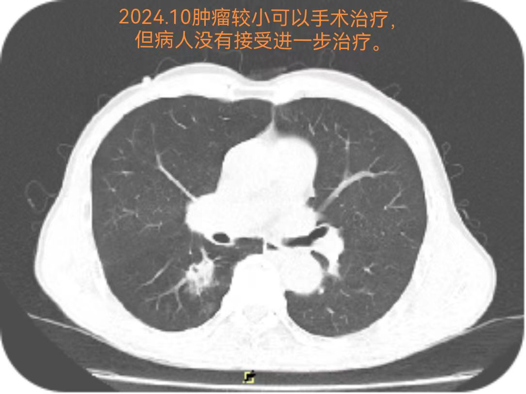 微信图片_2025-12-02_081017_6031.png 微信图片_2025-12-02_081017_6031.png
