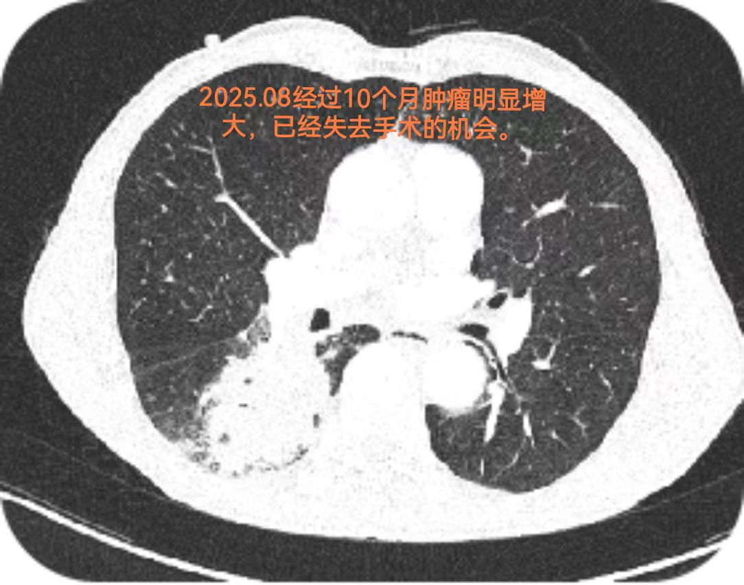 微信图片_2025-12-02_081020_908.png 微信图片_2025-12-02_081020_908.png