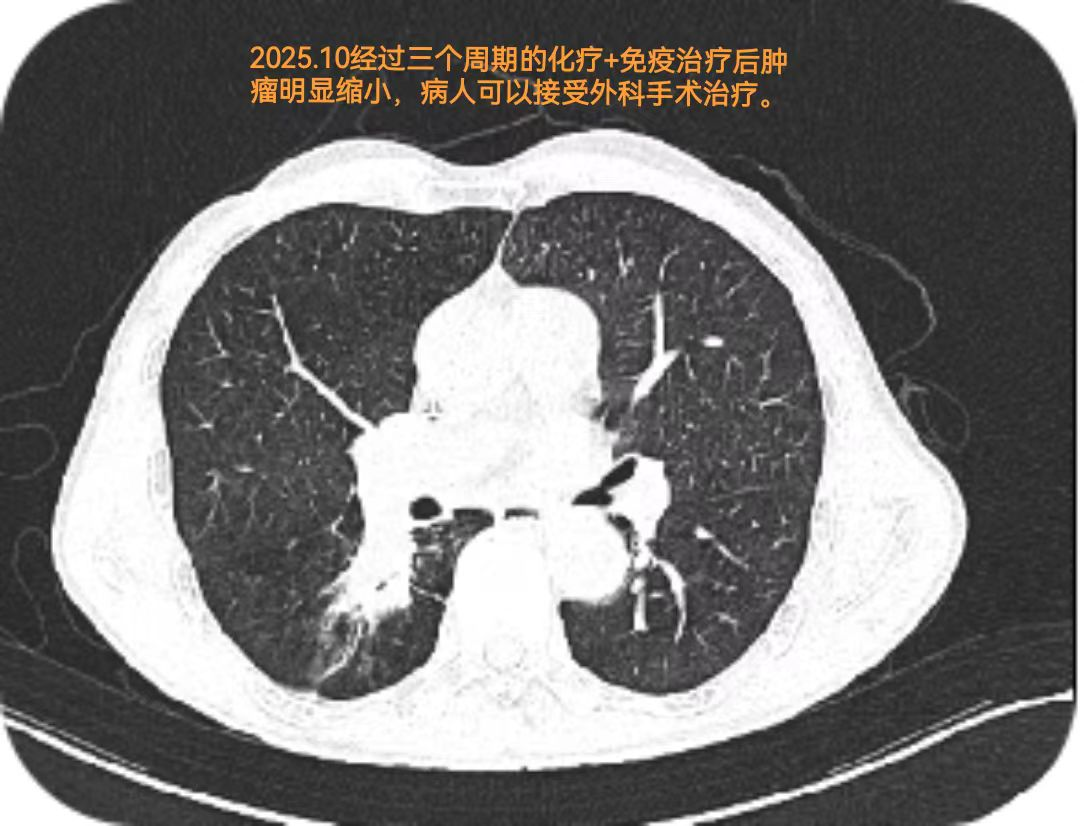 微信图片_2025-12-02_081025_684.png 微信图片_2025-12-02_081025_684.png