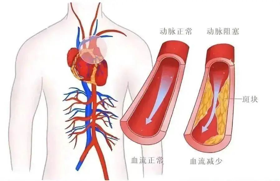 图片11.png 图片11.png